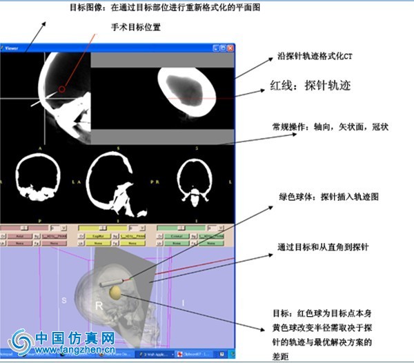 Ascension位置追踪器肿瘤学医学应用